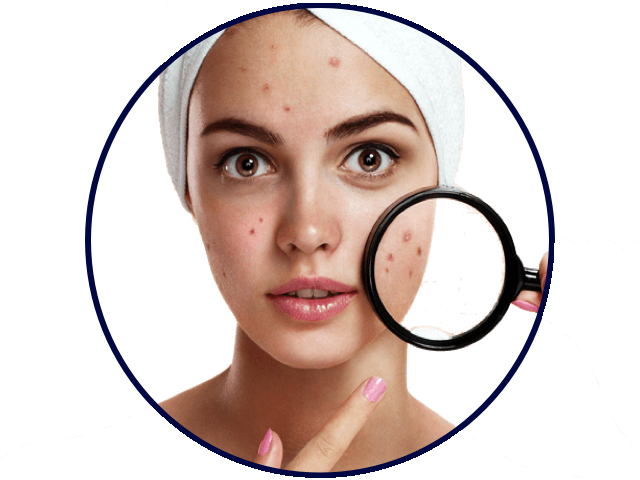 Top 10 Skin Care Products In Malaysia 10 Best Acne Spots Treatment